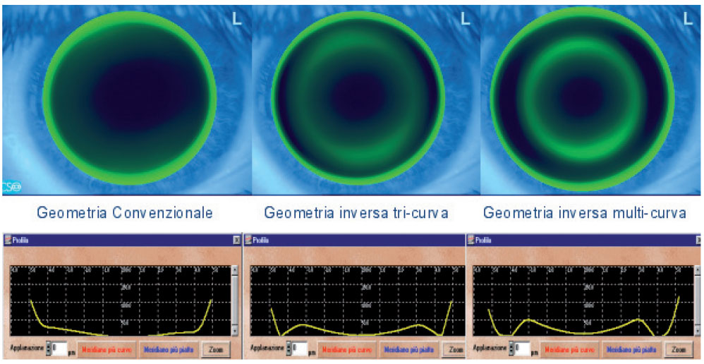 Quadri fluoresceinici per geometrie lenti Ortho-K