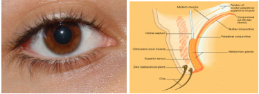 papilloma palpebrale occhio pentru unguent de veruci genitale