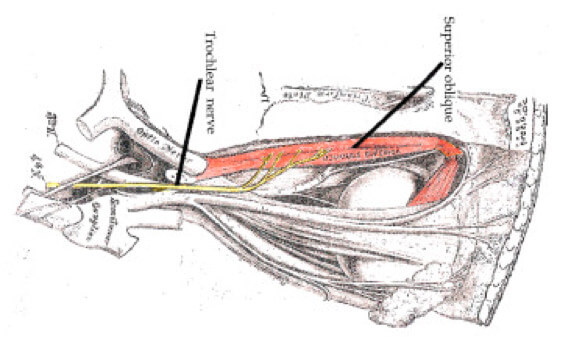 Nervo cranico trocleare
